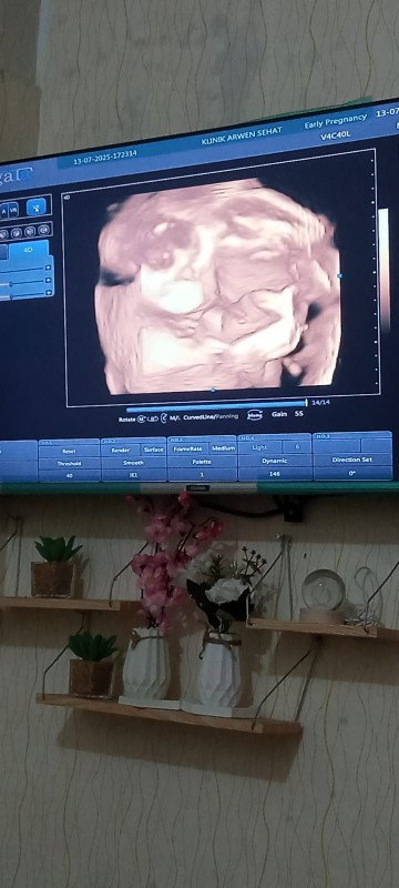 Usg hari ini