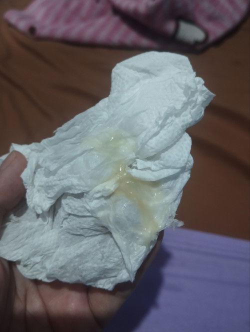 lendir melahirkan/keputihan
maaf kalo jorok