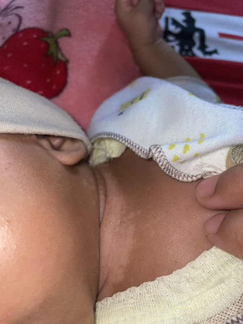 Kulit Leher berwarna putih