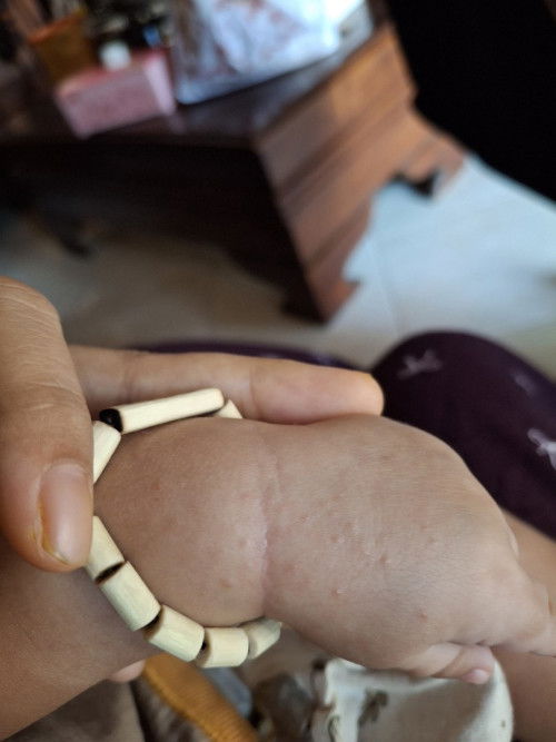 Bintik di tangan