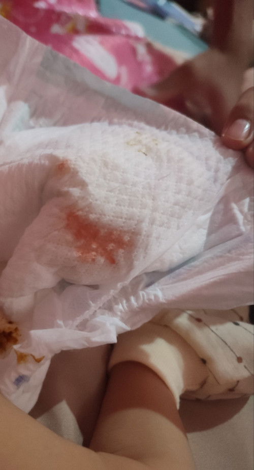 pampers bayi nb laki-laki ada noda darah