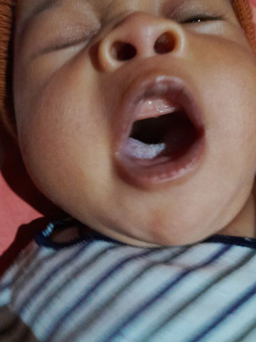 Jamur mulut