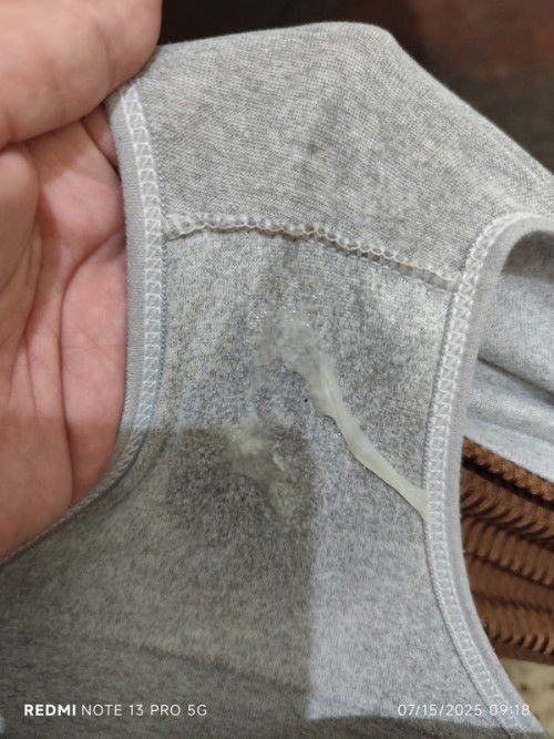 Mucus plug ba to?