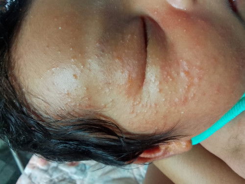 คุณแม่ท่านไหนพอรู้บ้างคะ?