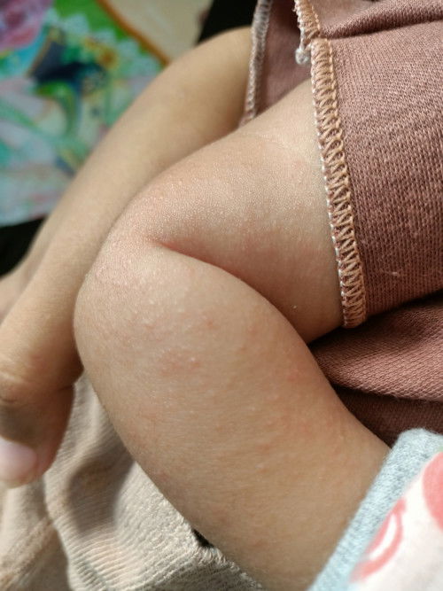Bayi jalan 2 bln