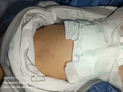 BINTIK DIPERUT BAYI USIA 4HARI