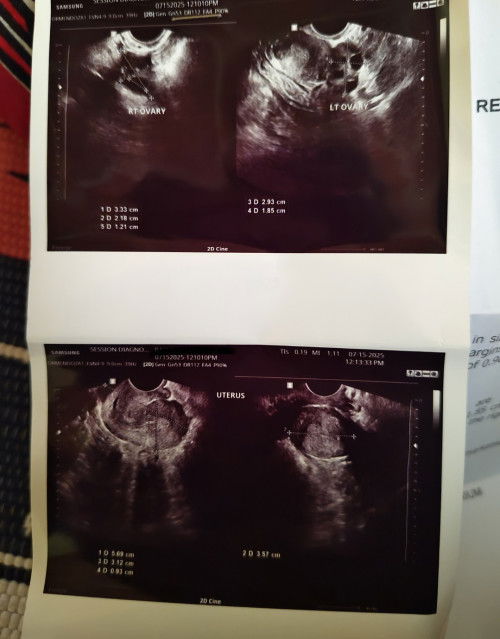 Ultrasound