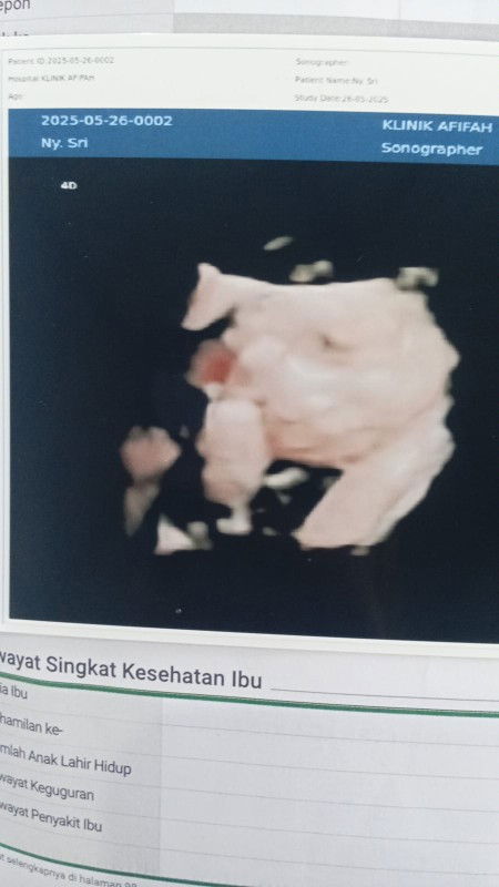 Post reply image