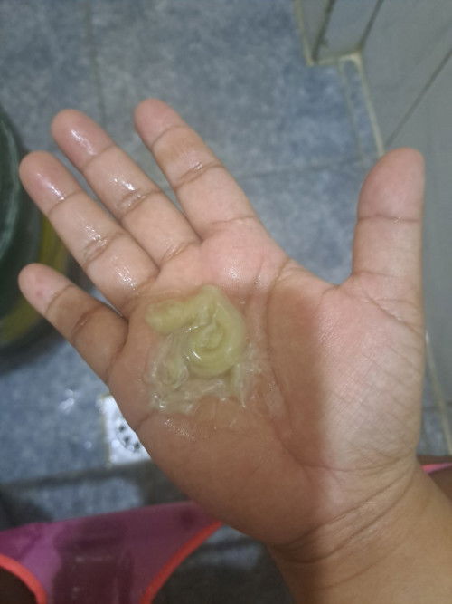 Ano po itong klaseng discharge po ito? 3cm na po kasi ako nung Monday