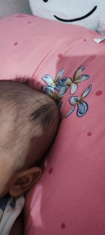 Kepala bayi di vacum