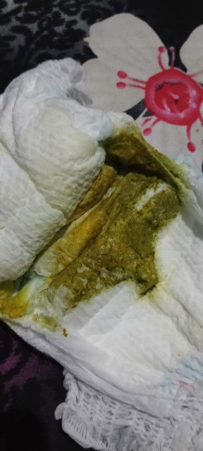 BAB bayi hijau