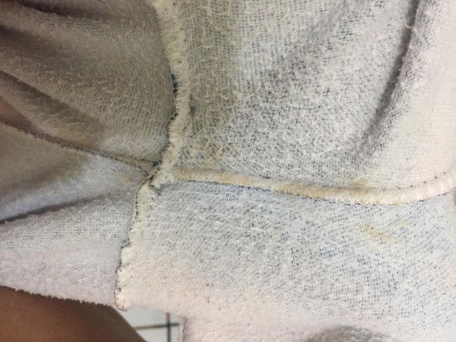 Brown discharge