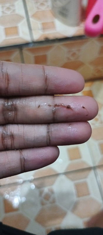 Keluar flek