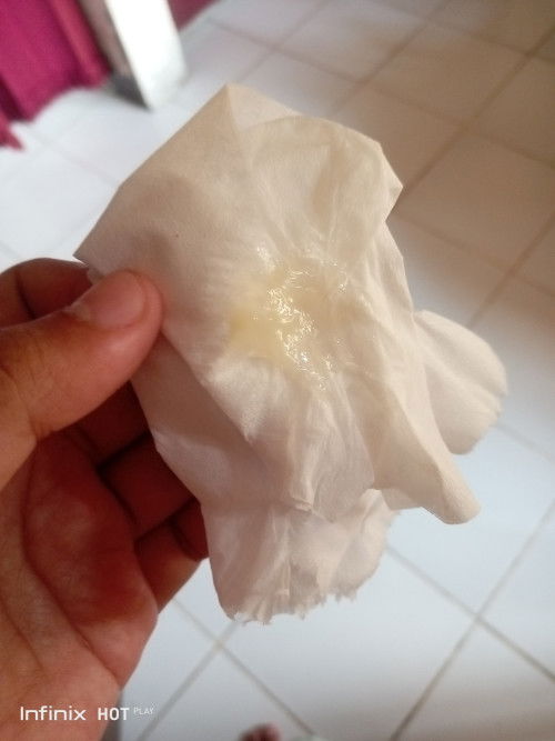 Mau tanya dong bund,ini keputihan apa ketuban rembes ya soal nya aku binggung gimna ngebedainya