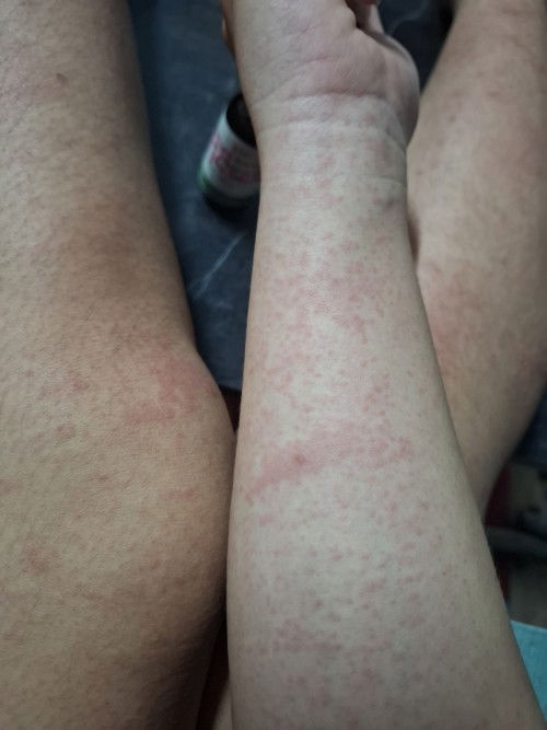 อาการแบบนี้คืออะไรค่ะอันตรายมั้ย