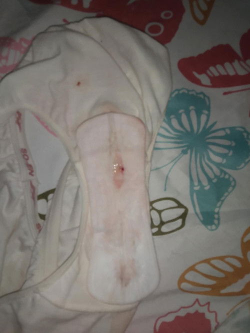 36 weeks and 4 days Mucus plug na po ba ito mga moms medyo malapot na may bahid ng dugo...