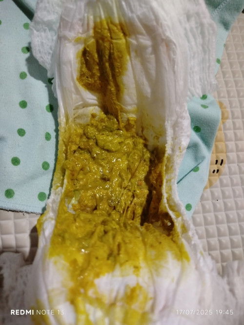 Pup bayi 6 bulan 16 hari