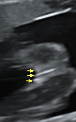 Gender babyyyy
