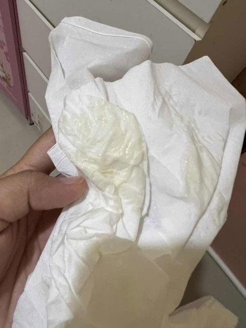 Air ketuban atau keputihan