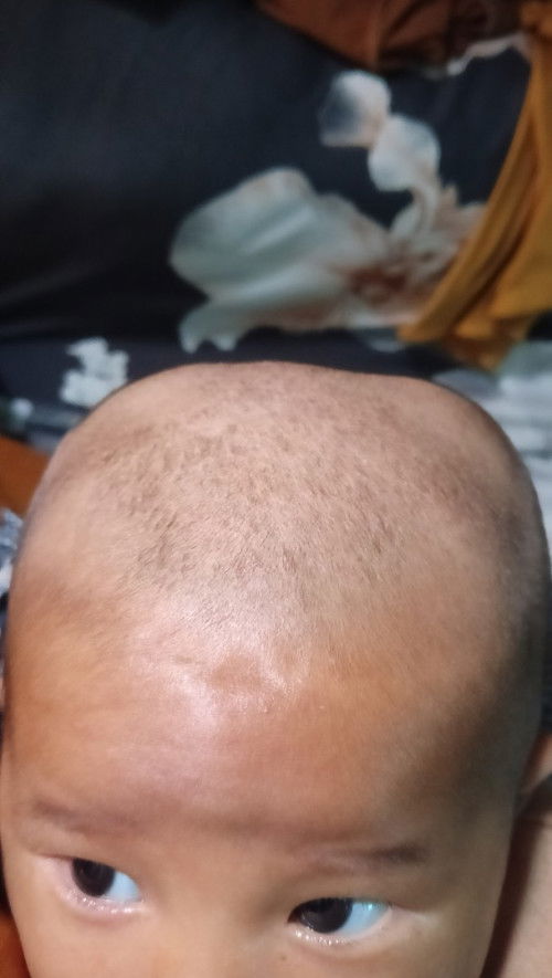 Kepala bayi