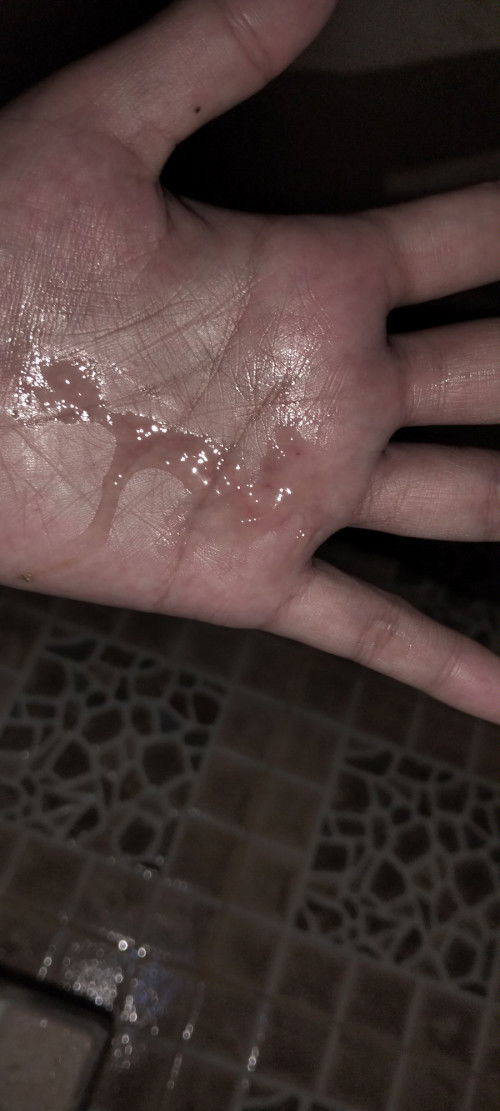 Bun mau tanya kalo ini apa yaa saya kehamilan udah 39 week 3 hari