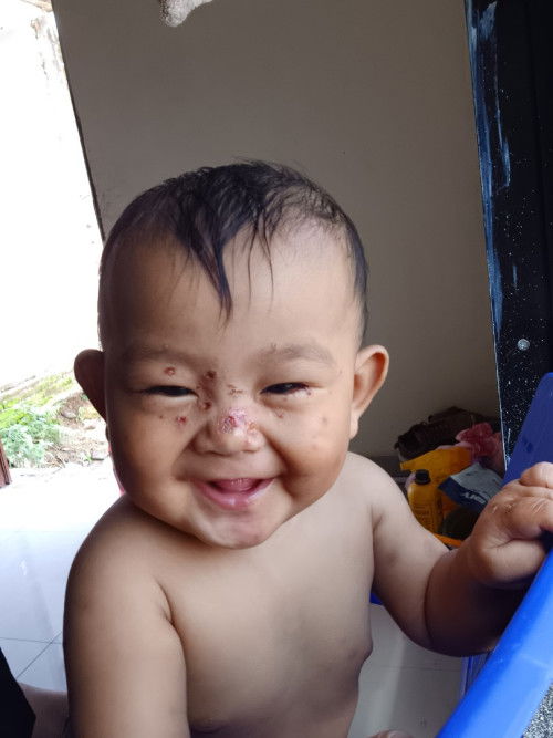 Merah berair diwajah