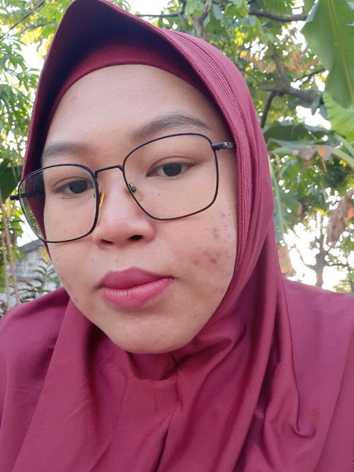 HAMIL 25WEEK MUKA JERAWATAN BINGUNG MAU PAKAI SKINCARE YG AMAN BUMIL