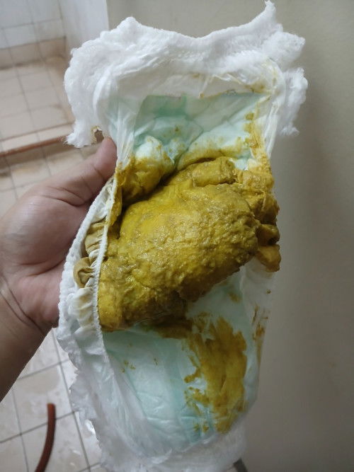 Baby kerap berak
