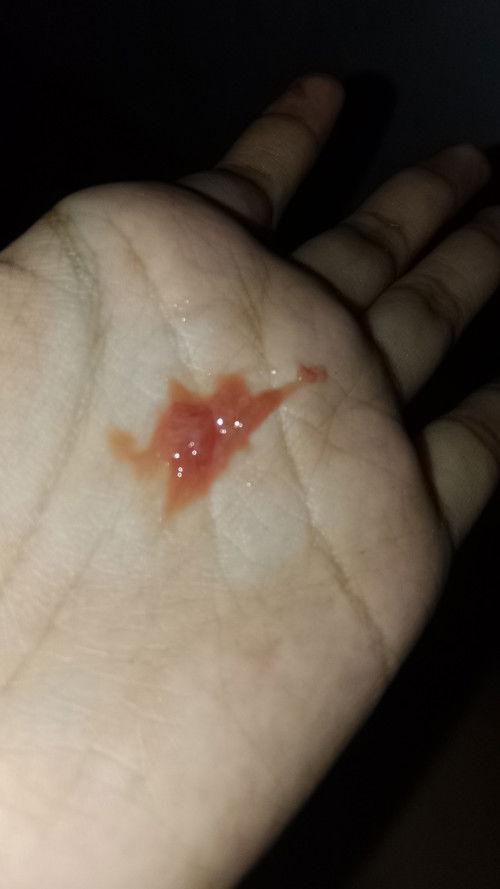 Keluar flek saat hamil 5 bulan