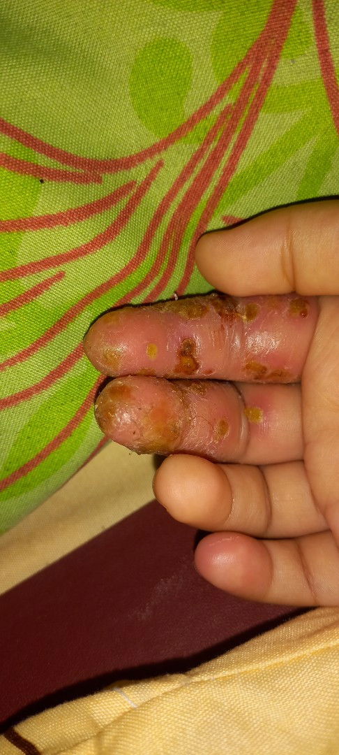 Ada yang tau ini kenapa dan obat apa yah kasian anak aq