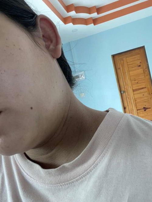 คอดำมากๆ เกิดจากอะไร??