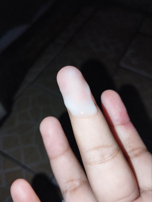 keputihan kentall knp?