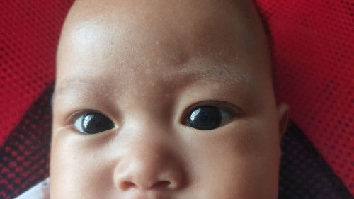 Di alis ada bintik putih