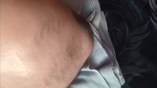 Caput pada bayi 2 bulan