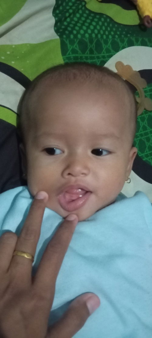 Apakah biasa bayi tumbuh gigi pertama disamping dulu