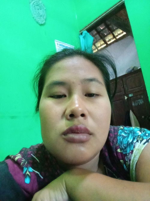 36 minggu skit gigi bengkak ada yg sama?