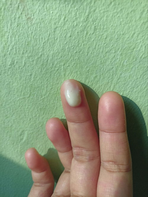 keputihan saat hamil