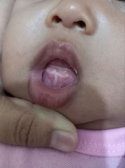 Tumbuh gigi