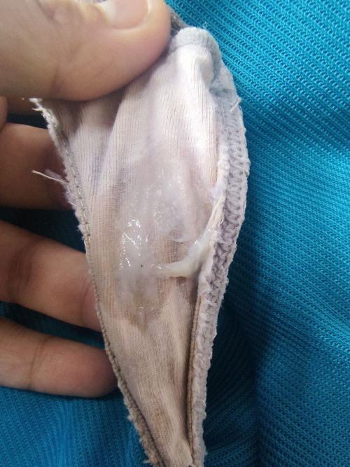 Ito na po ba yung sinasabi nila na discharge para malaman kung bukas na po yung cervix?