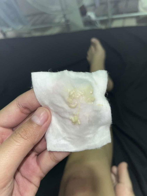 แบบนี้คือตกขาวอะไรหรอค่ะ อันตรายไหม