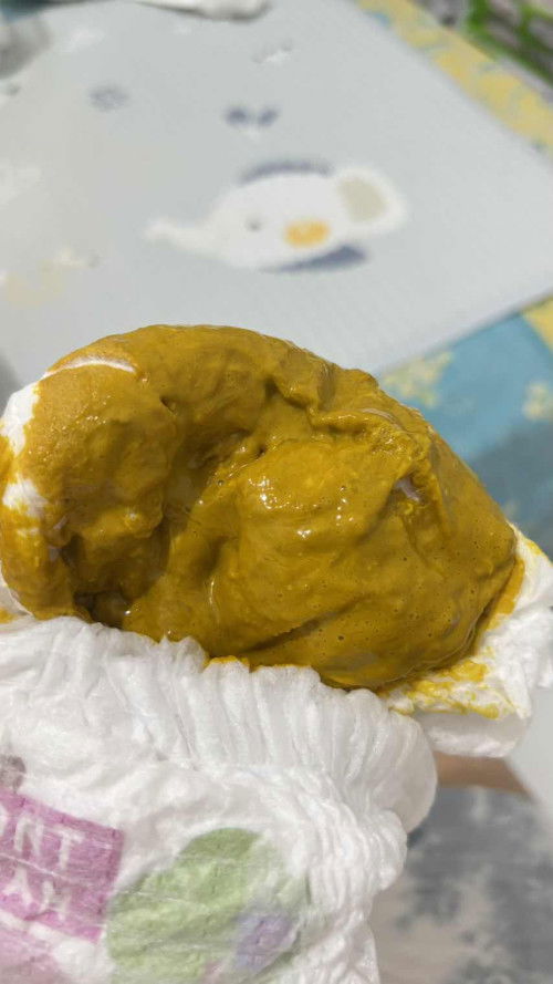 BAB Bayi 2 bulan Normal/tidak