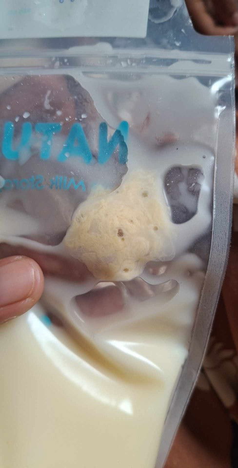 นมแม่เป็นก้อน