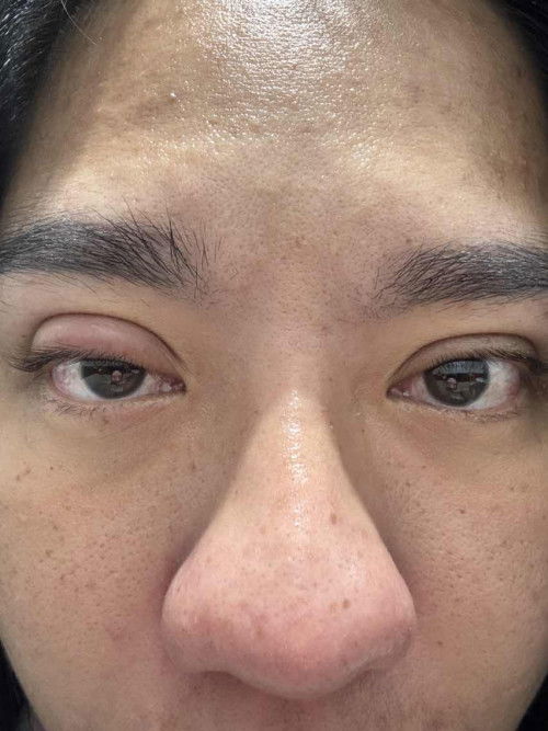 ขออนุญาตสอบถามแม่ๆคะ