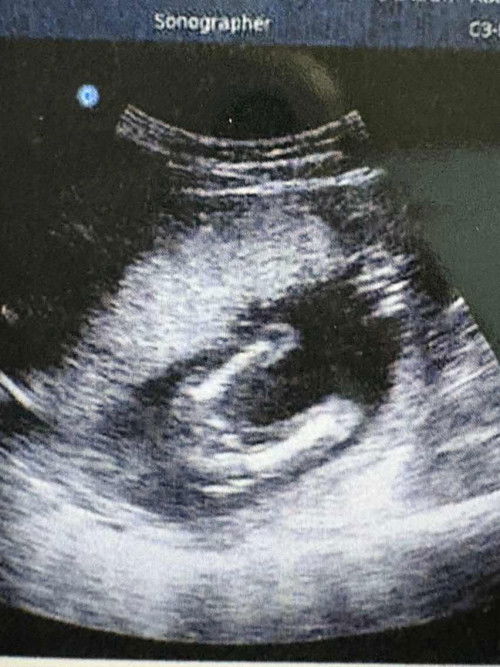 GIRL or BOY