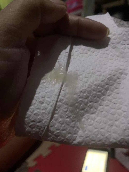 White Discharge