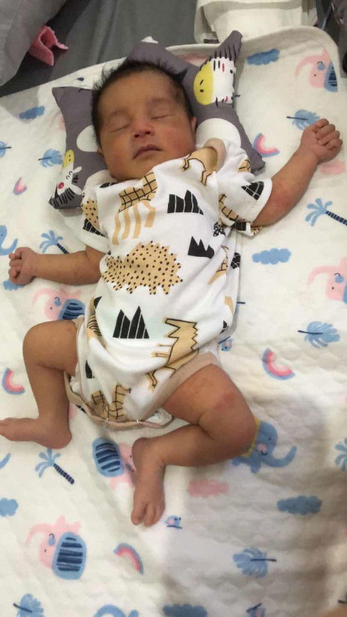 Bentol merah pada bayi