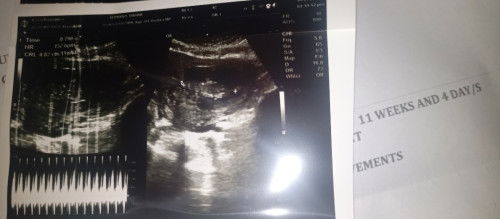 The gender😁