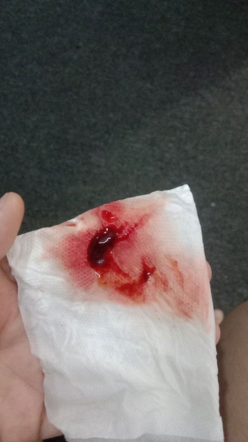 Saya mengandung 9 minggu pagi ni buang air kecil ada kluar darah saya risau😢😢