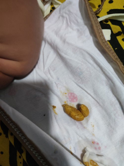 Jangan di klik kalo jijik bund