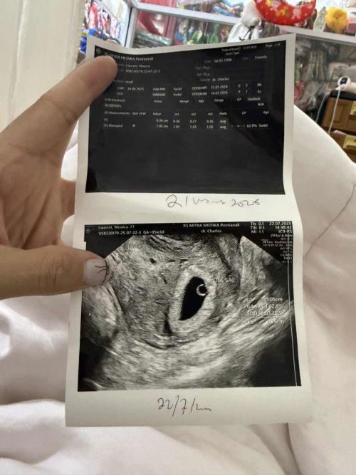 14 juni HPHT sudah USG hasilnya 5 minggu 6 hari. Dan sudah ada yolksac